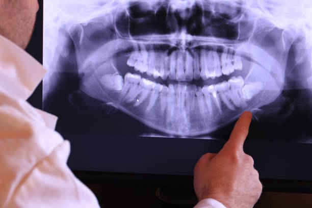 Best Emergency Root Canal Treatment in Mcclure, PA