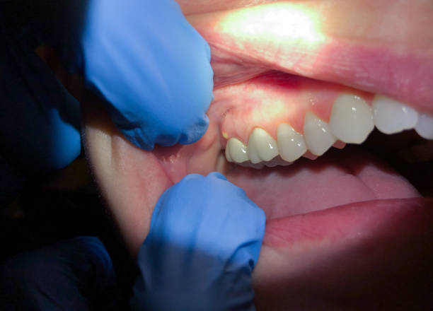 Best Emergency Cosmetic Dentistry in Mcclure, PA